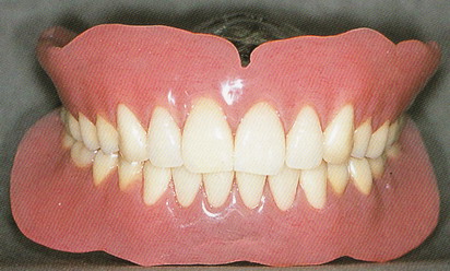 「差し歯・入れ歯」専門医による診療を受けてみませんか？02