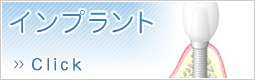 インプラント