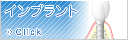 インプラント