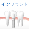 インプラント