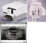 体に優しく、説明がわかりやすいＸ線撮影